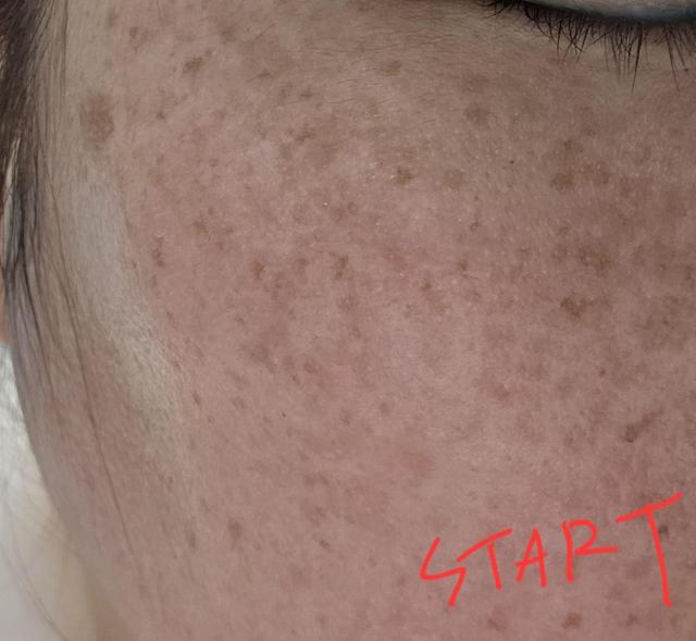 review_image