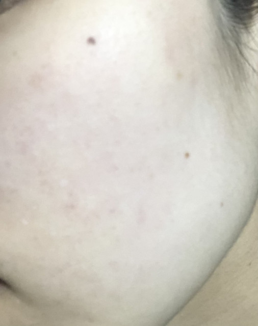 review_image