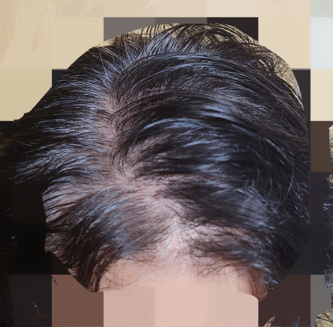 review_image