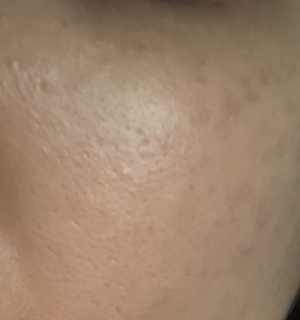 review_image